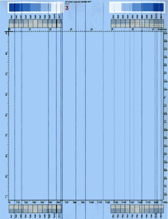 Vertical line(s) or line segment(s)