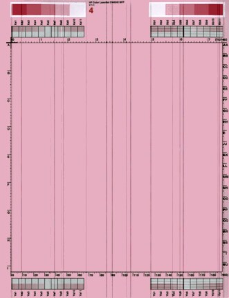 Vertical line(s) or line segment(s)