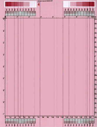 Vertical line(s) or line segment(s)