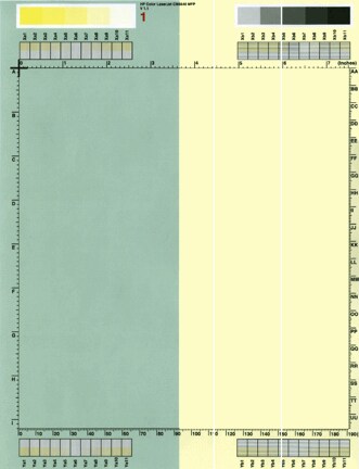 White vertical line(s) or band(s)