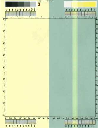 White vertical line(s) or band(s)