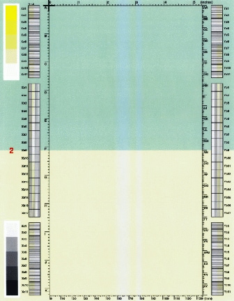 White vertical line(s) or band(s)