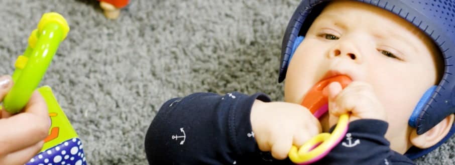 Baby wearing 3D printed orthotics on their head while playing on floor 