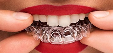 Revolutionizing clear aligners in 3D printing dental: MJF's breakthrough in mass customization