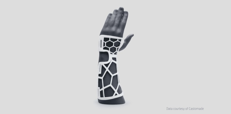 3d printed orthoses by Castomade